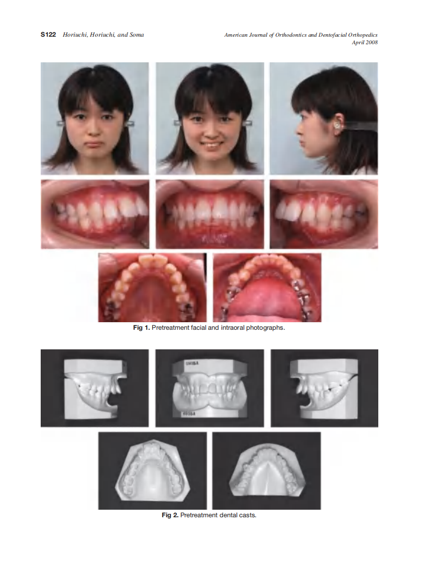 2008_133_4-Suppl-1_S121_S129_Horiuchi.pdf 第2页