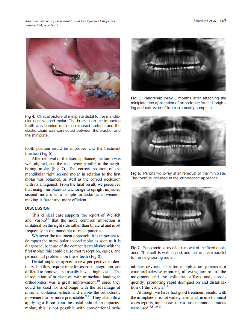2008_134_1_145_148_Miyahira.pdf 第3页
