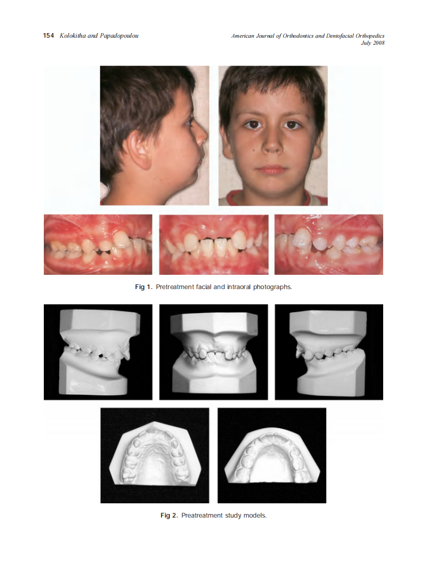 2008_134_1_153_160_Kolokitha.pdf 第2页