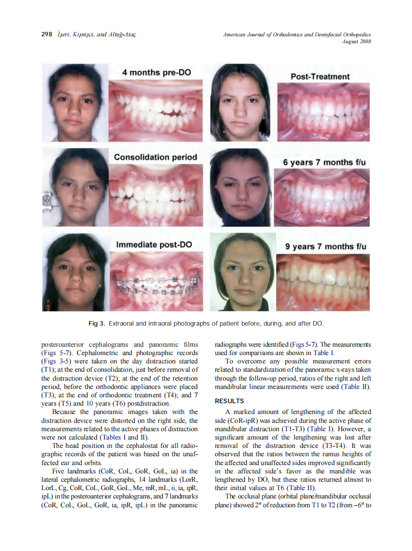 2008_134_2_296_304_Iseri.pdf 第3页