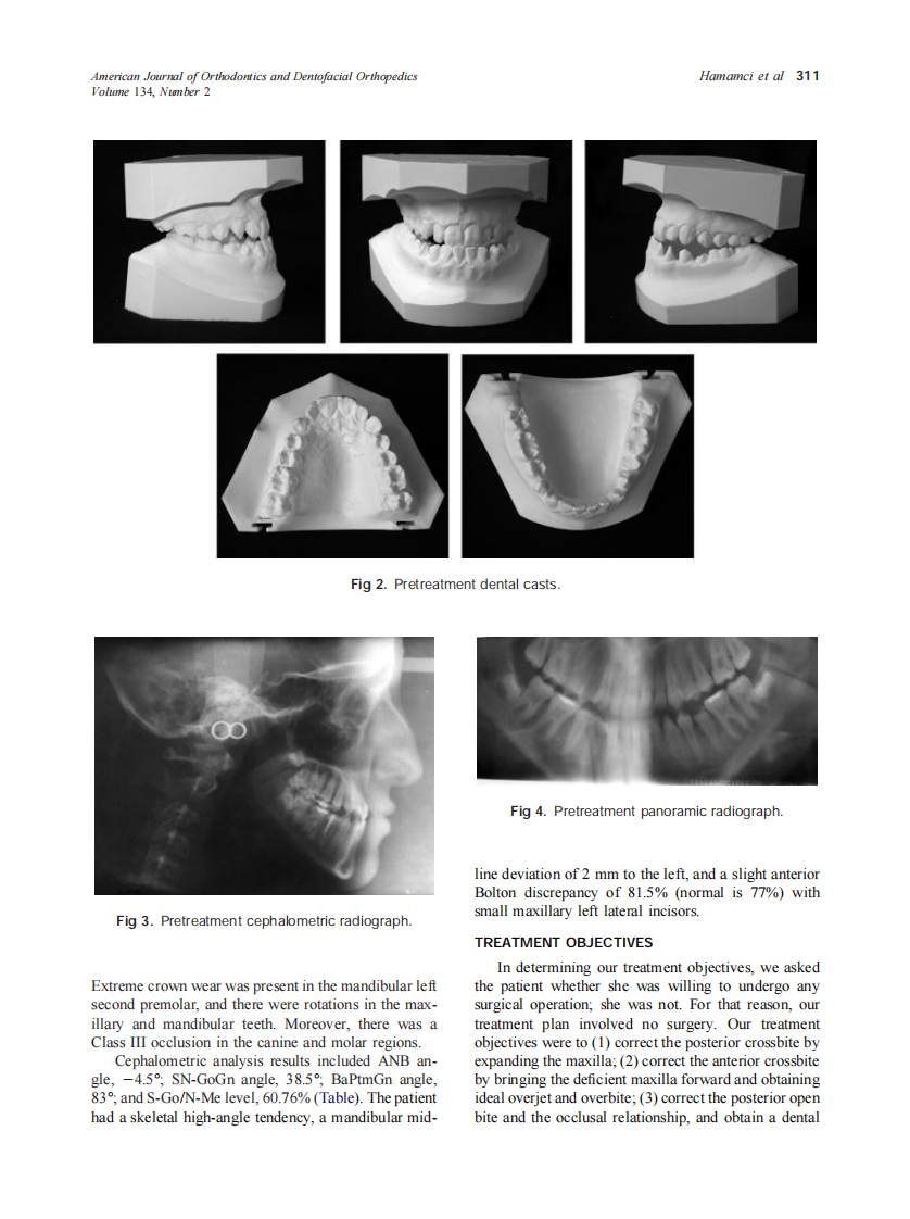 2008_134_2_309_317_Hamamci.pdf 第3页