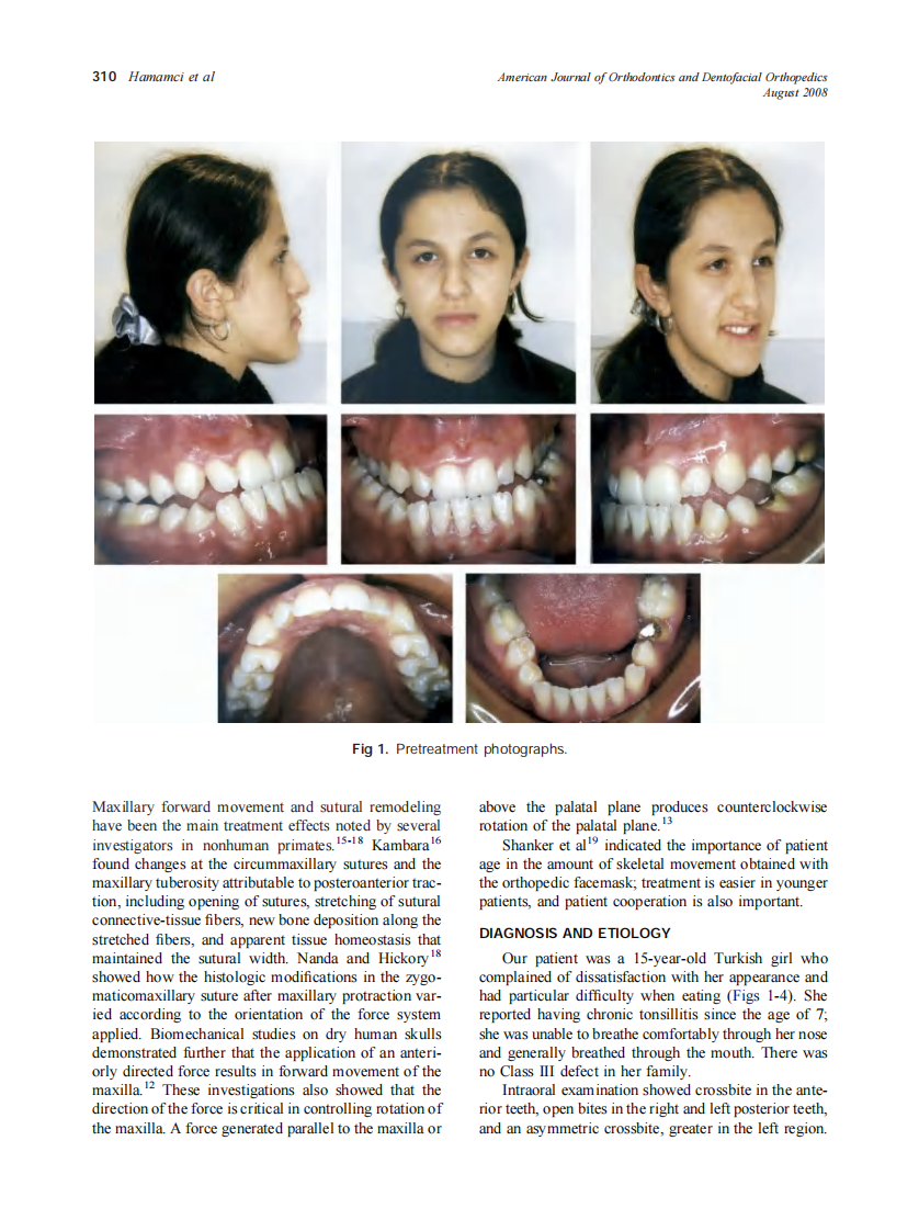 2008_134_2_309_317_Hamamci.pdf 第2页