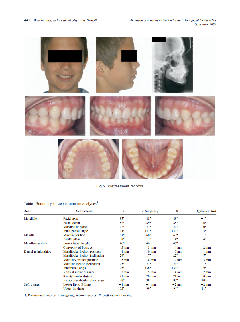 2008_134_3_439_446_Wiechmann.pdf 第4页