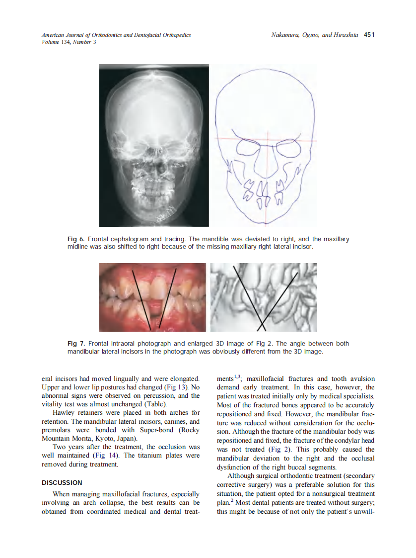 2008_134_3_447_455_Nakamura.pdf 第5页