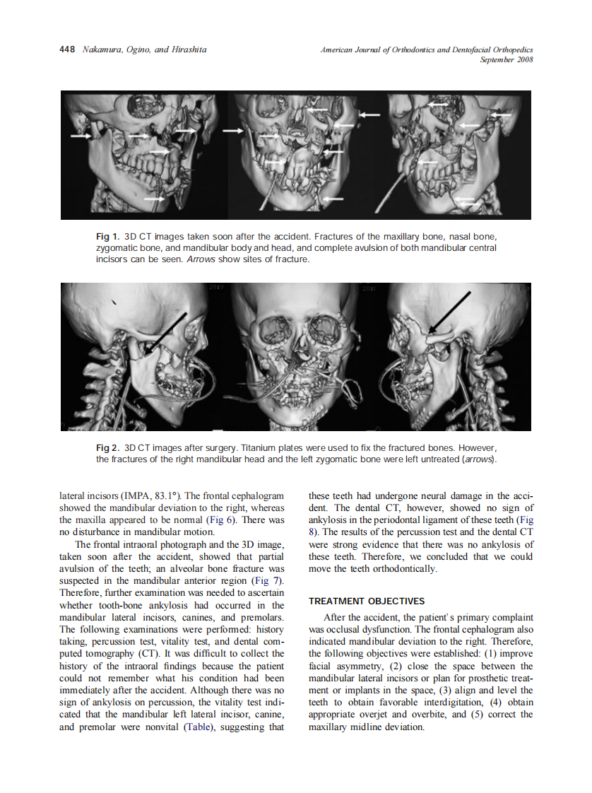 2008_134_3_447_455_Nakamura.pdf 第2页