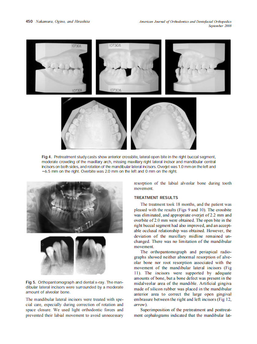 2008_134_3_447_455_Nakamura.pdf 第4页