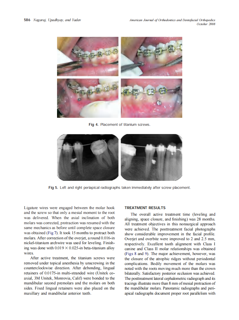 2008_134_4_583_591_Nagaraj.pdf 第4页
