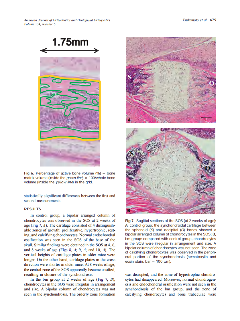 2008_134_5_676_683_Tsukamoto.pdf 第4页