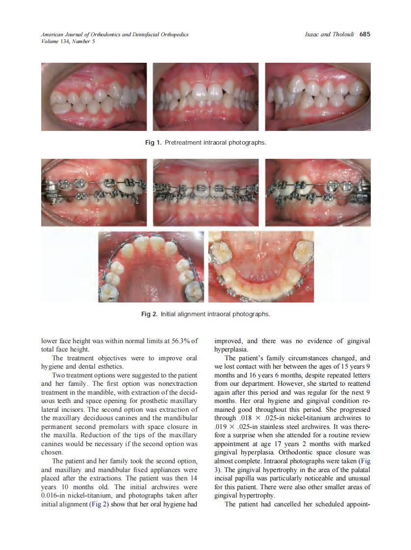 2008_134_5_684_688_Isaac.pdf 第2页