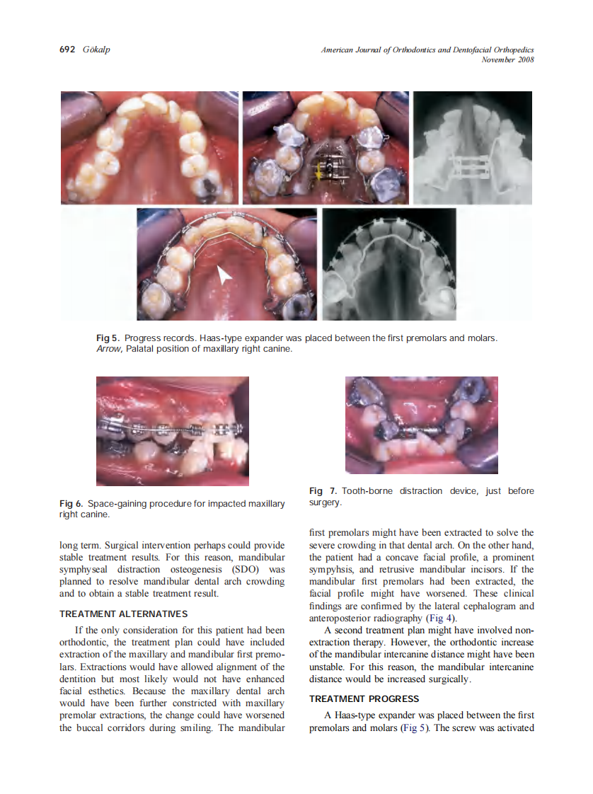 2008_134_5_689_699_Gokalp.pdf 第4页