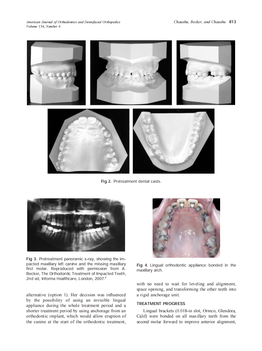 2008_134_6_811_819_Chaushu.pdf 第3页