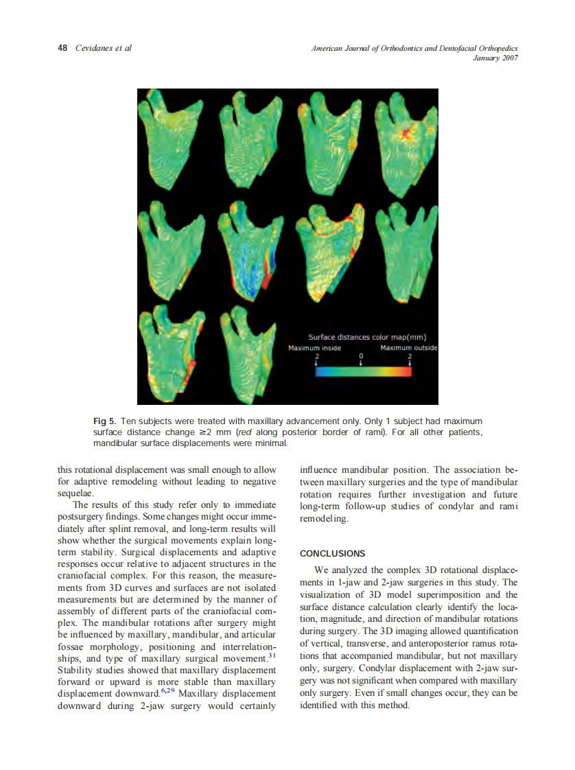 2007_131_1_44_50_Cevidanes.pdf 第5页