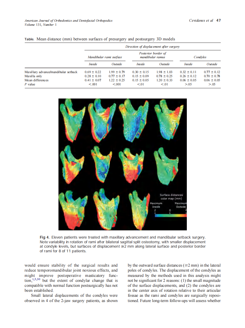 2007_131_1_44_50_Cevidanes.pdf 第4页