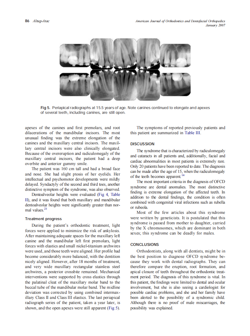 2007_131_1_83_88_Altug-Atac.pdf 第4页