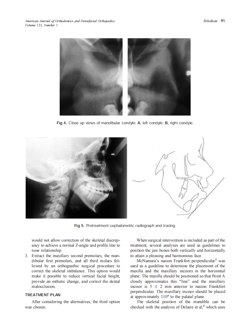 2007_131_1_89_97_Bilodeau.pdf 第3页