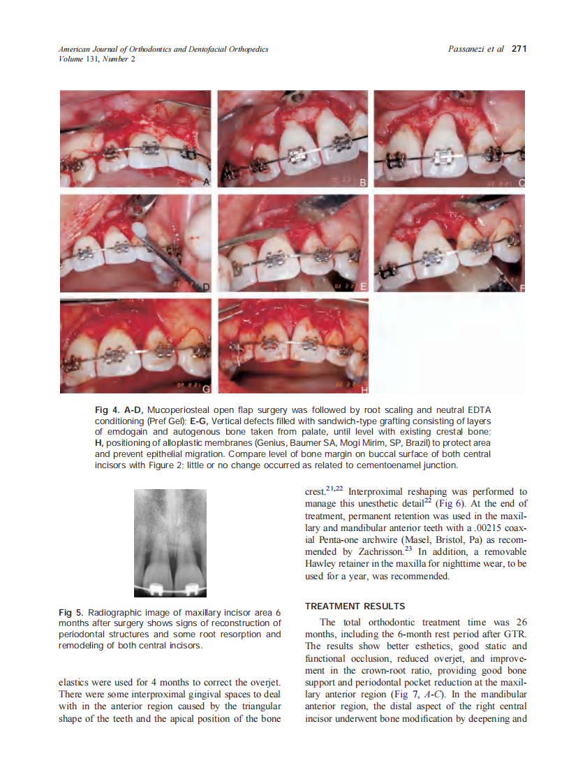 2007_131_2_268_276_Passanezi.pdf 第4页