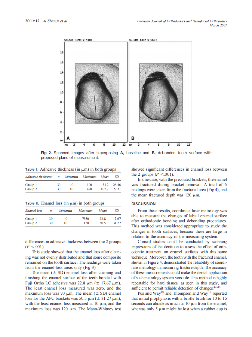2007_131_3_301.e9_301.e15_Al-Shamsi.pdf 第4页
