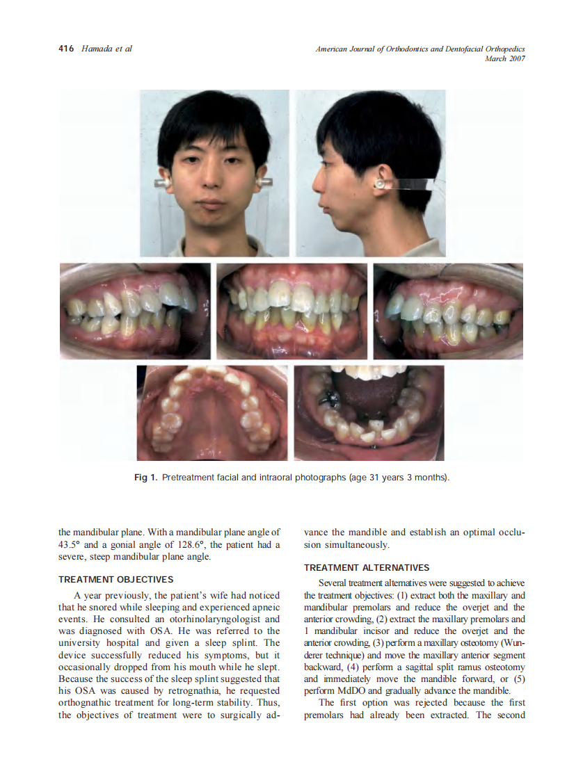 2007_131_3_415_425_Hamada.pdf 第2页