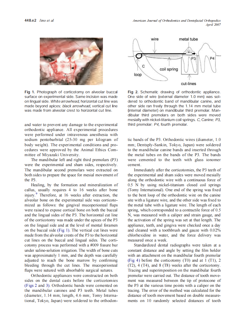 2007_131_4_448.e1_448.e8_Iino.pdf 第2页
