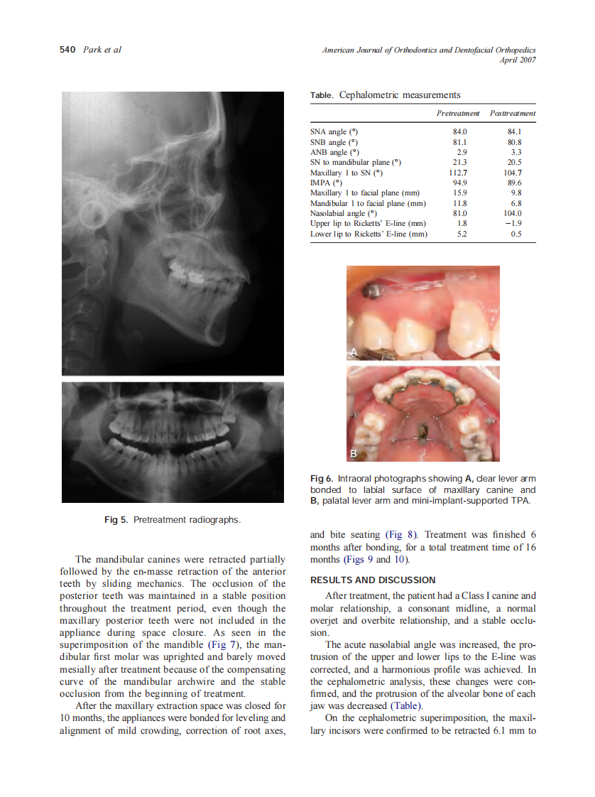 2007_131_4_537_544_Park.pdf 第4页