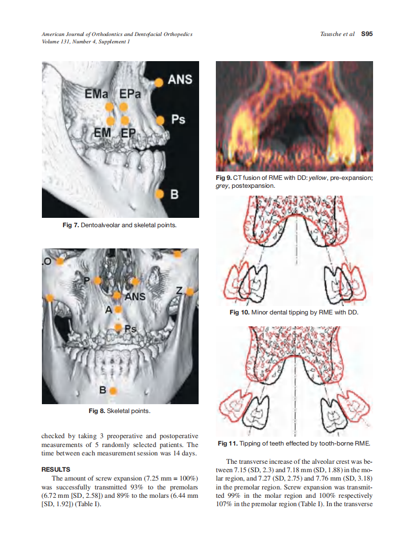 2007_131_4-Suppl-1_S92_S99_Tausche.pdf 第4页