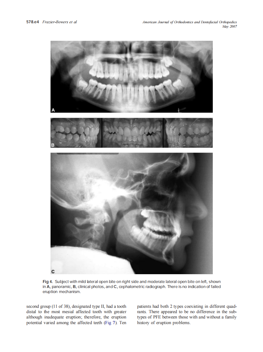 2007_131_5_578.e1_578.e11_Frazier-Bowers.pdf 第4页
