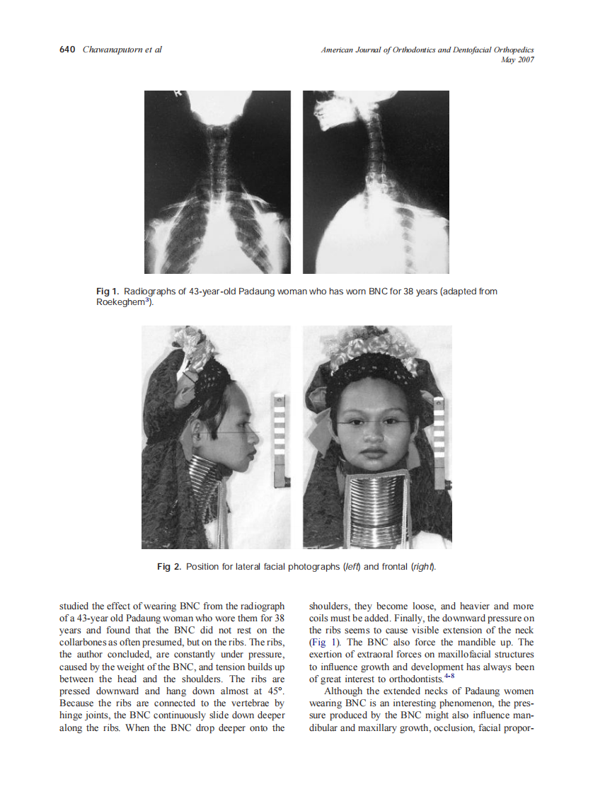 2007_131_5_639_645_Chawanaputorn.pdf 第2页