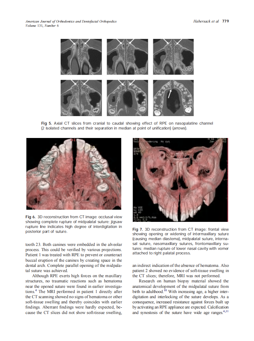 2007_131_6_776_781_Habersack.pdf 第4页