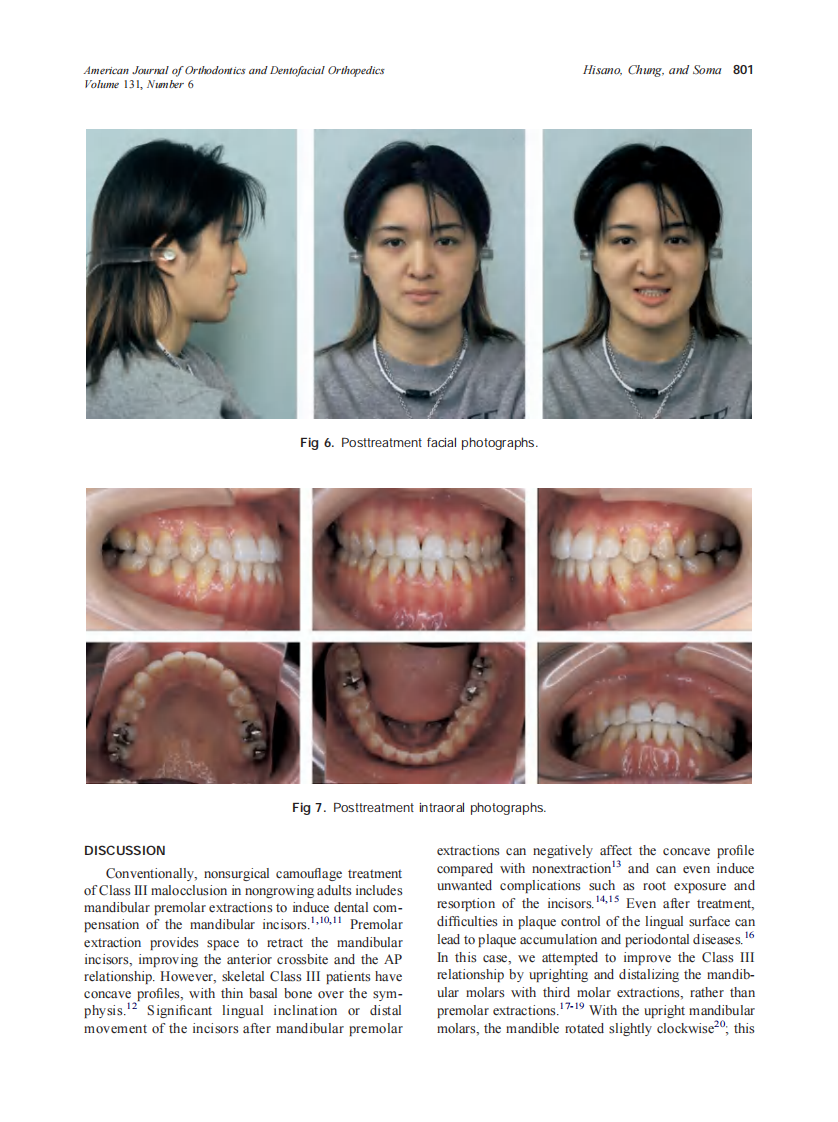 2007_131_6_797_804_Hisano.pdf 第5页