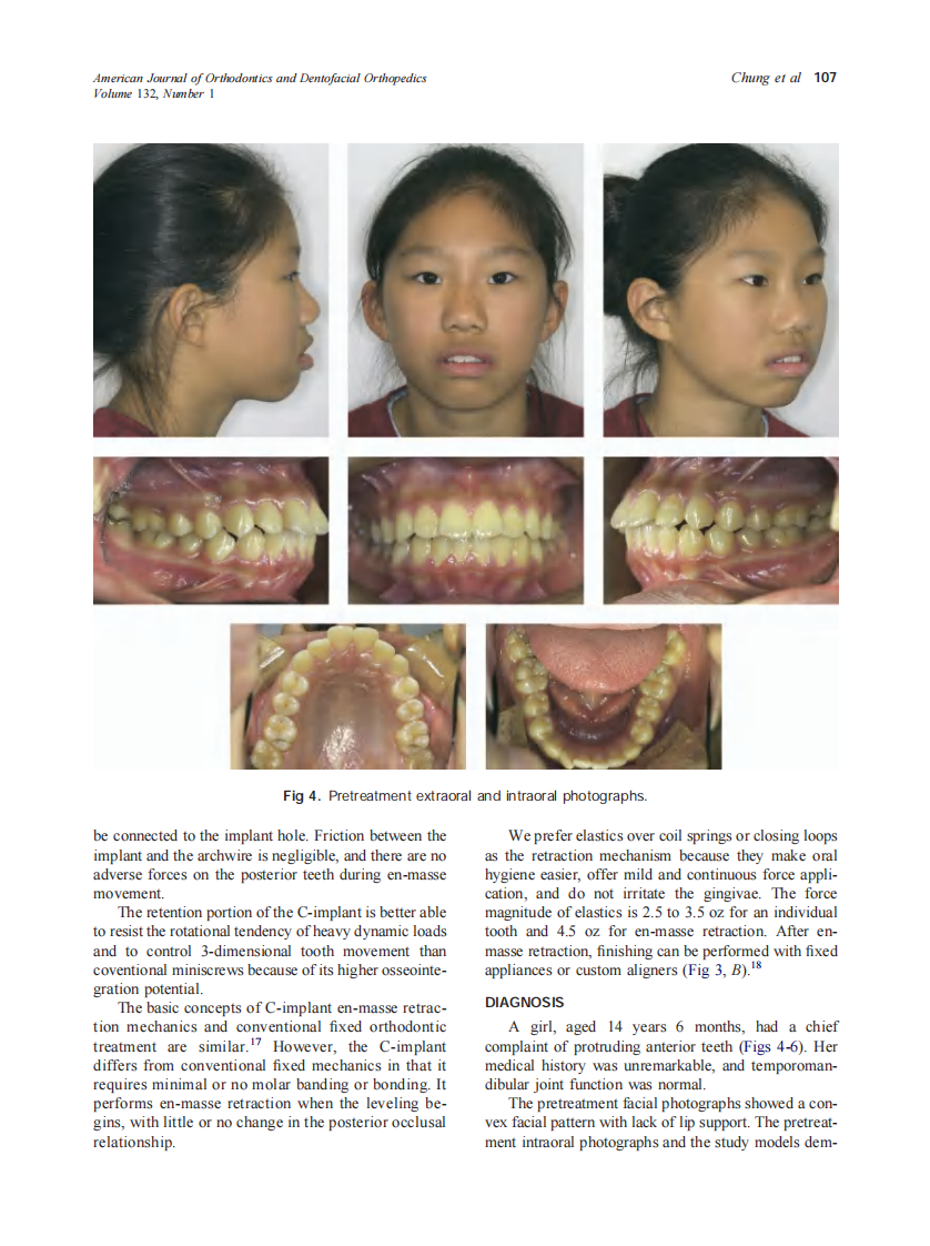 2007_132_1_105_115_Chung.pdf 第3页