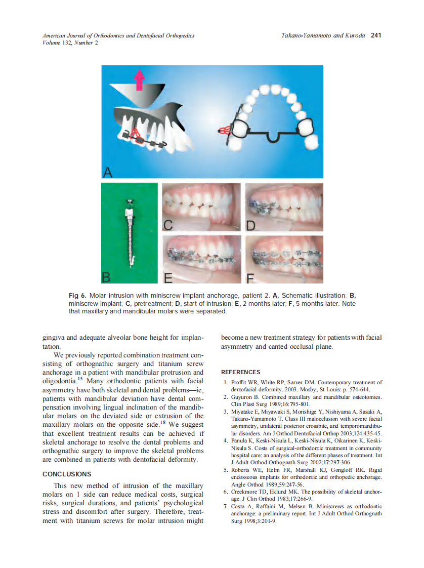 2007_132_2_237_242_Takano-Yamamoto.pdf 第5页