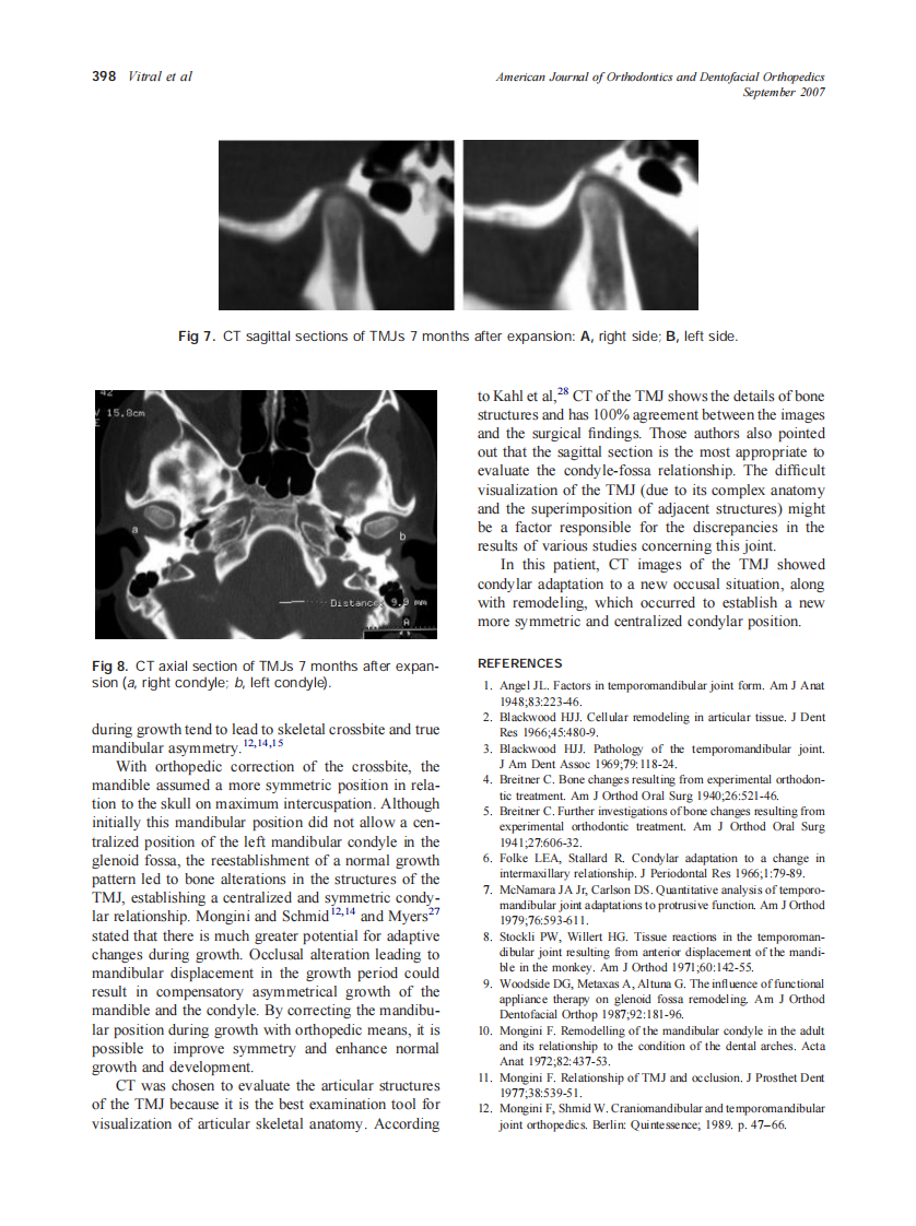 2007_132_3_395_399_Vitral.pdf 第4页