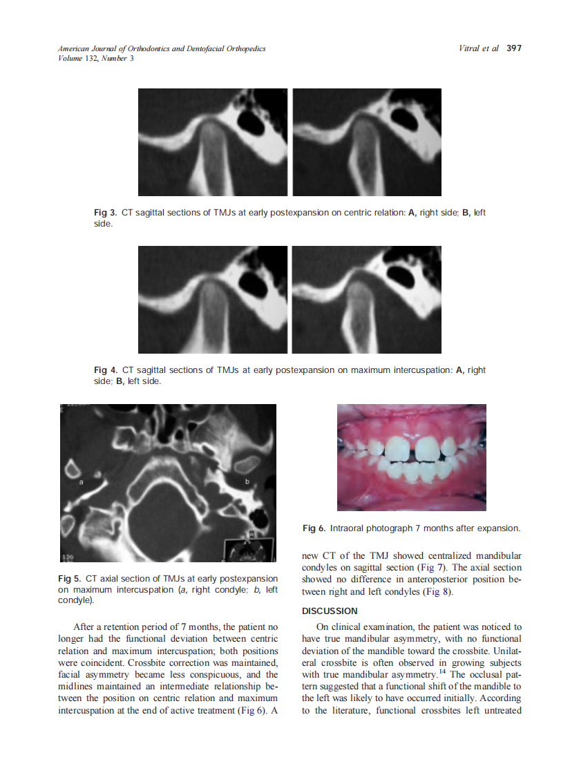 2007_132_3_395_399_Vitral.pdf 第3页