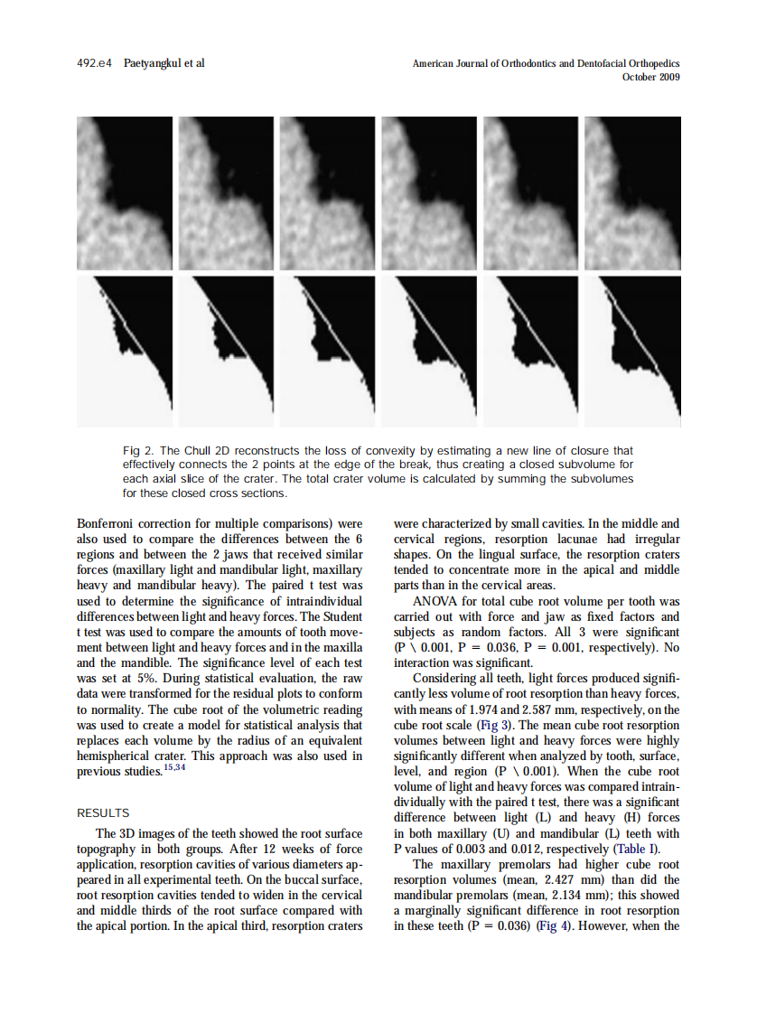 Paetyangkul_2009_American-Journal-of-Orthodontics-and-Dentofacial-Orthopedics.pdf 第4页