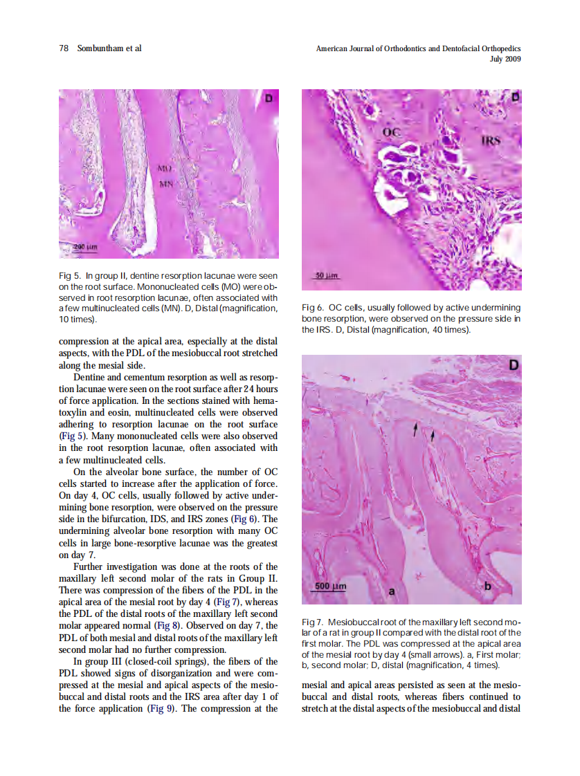 Sombuntham_Early-tooth-movement-with-a-clear-plastic-appliance-in-rats_2009.pdf 第4页