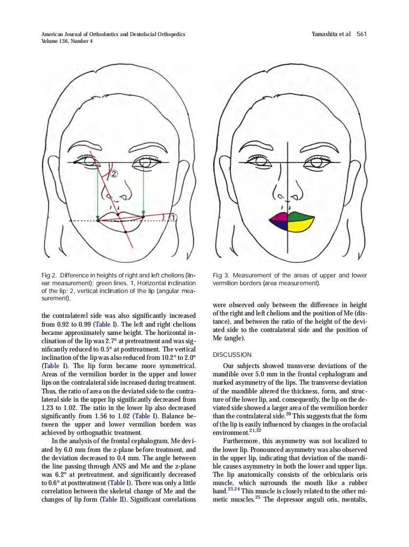 Yamashita_2009_American-Journal-of-Orthodontics-and-Dentofacial-Orthopedics.pdf 第3页