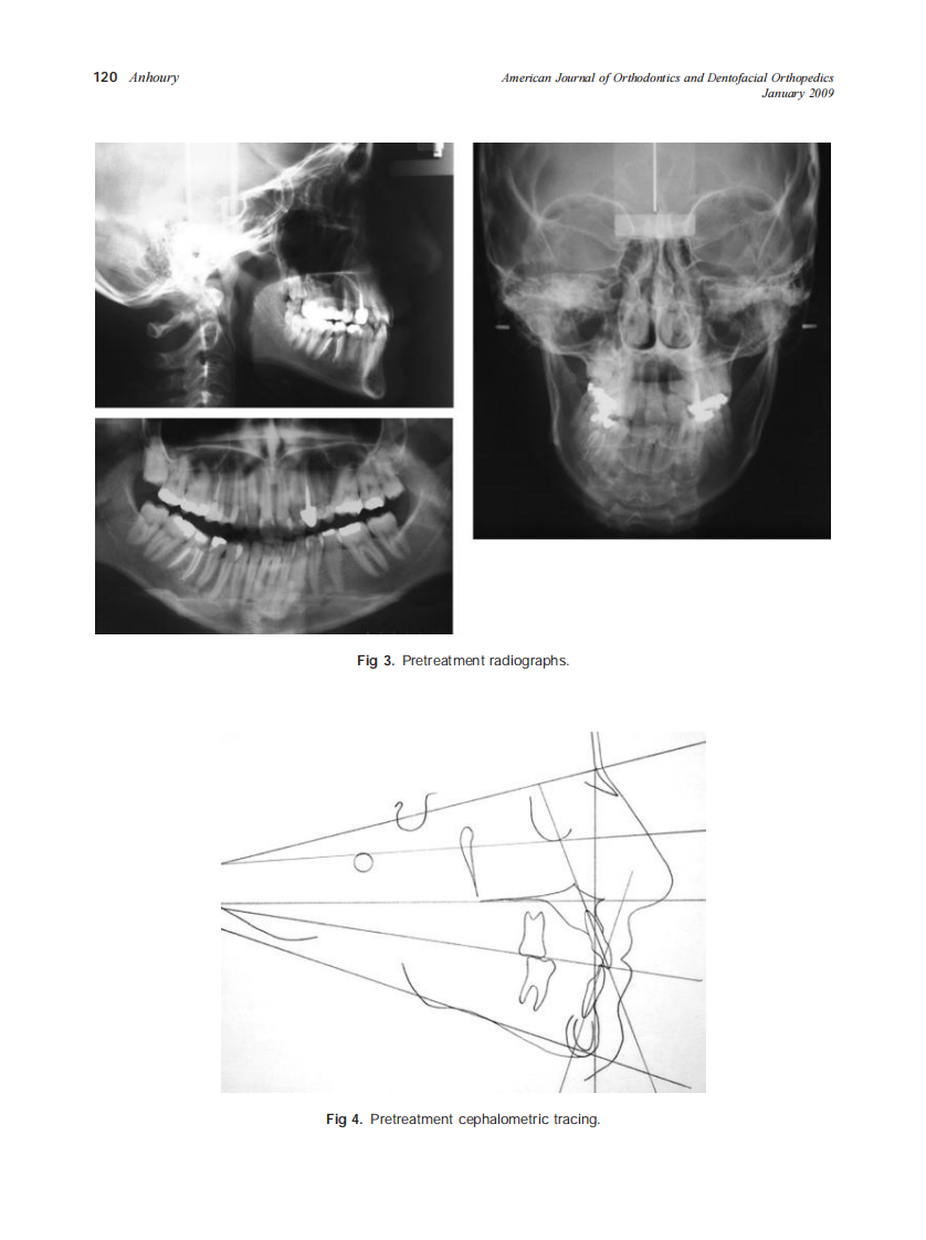 2009_135_1_118_126_Anhoury.pdf 第3页