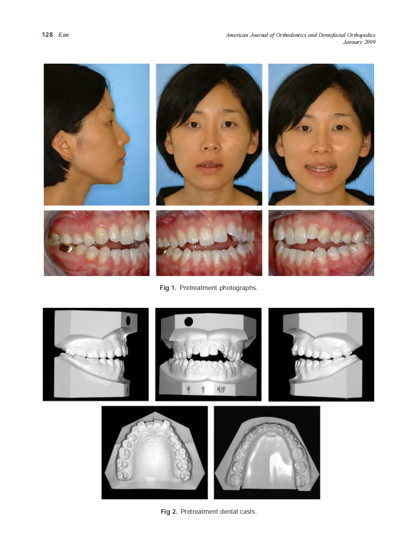 2009_135_1_127_132_Kim.pdf 第2页