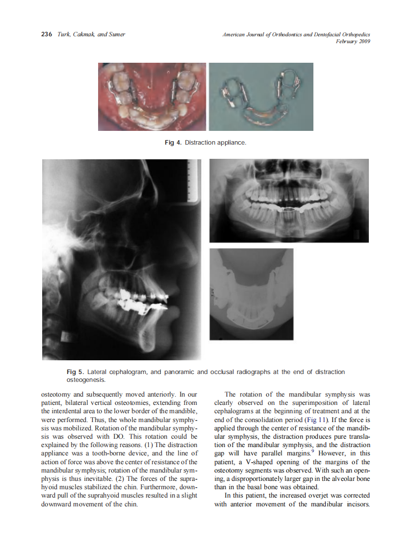 2009_135_2_232_240_Turk.pdf 第5页