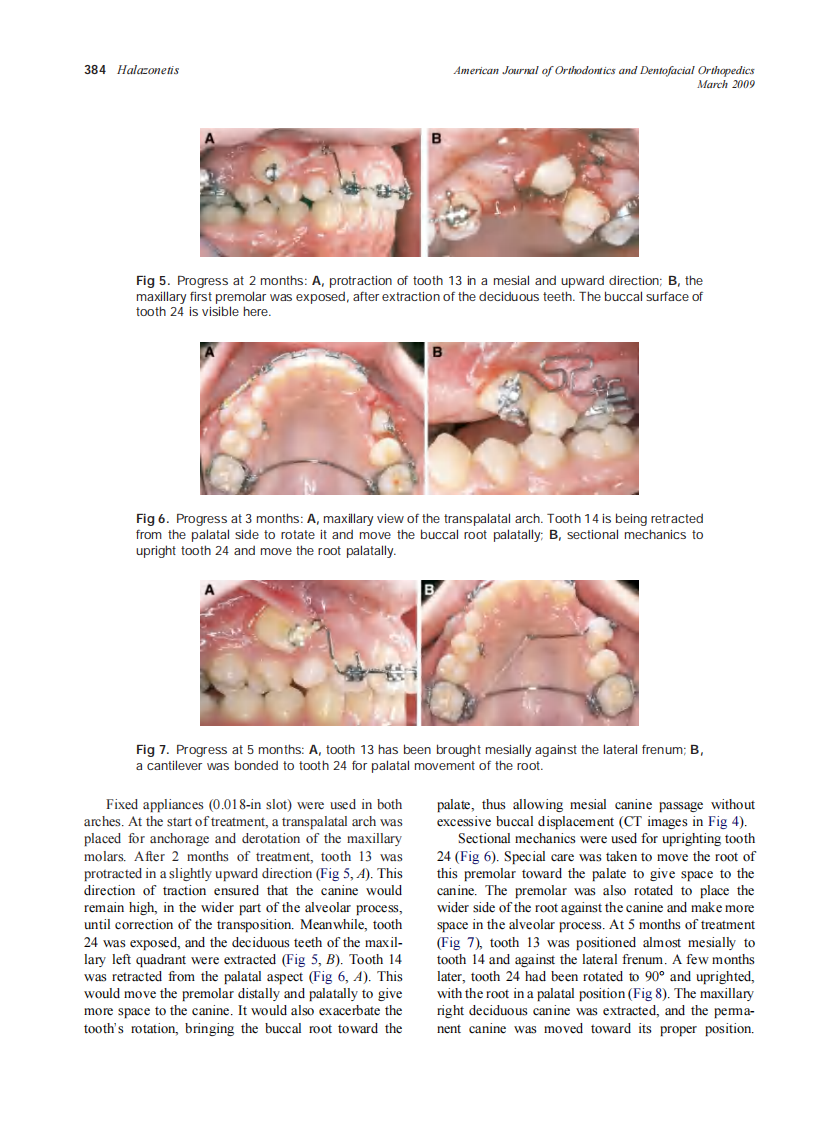 2009_135_3_380_389_Halazonetis.pdf 第5页
