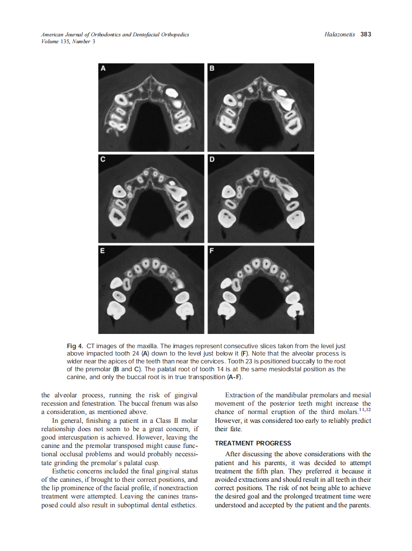 2009_135_3_380_389_Halazonetis.pdf 第4页