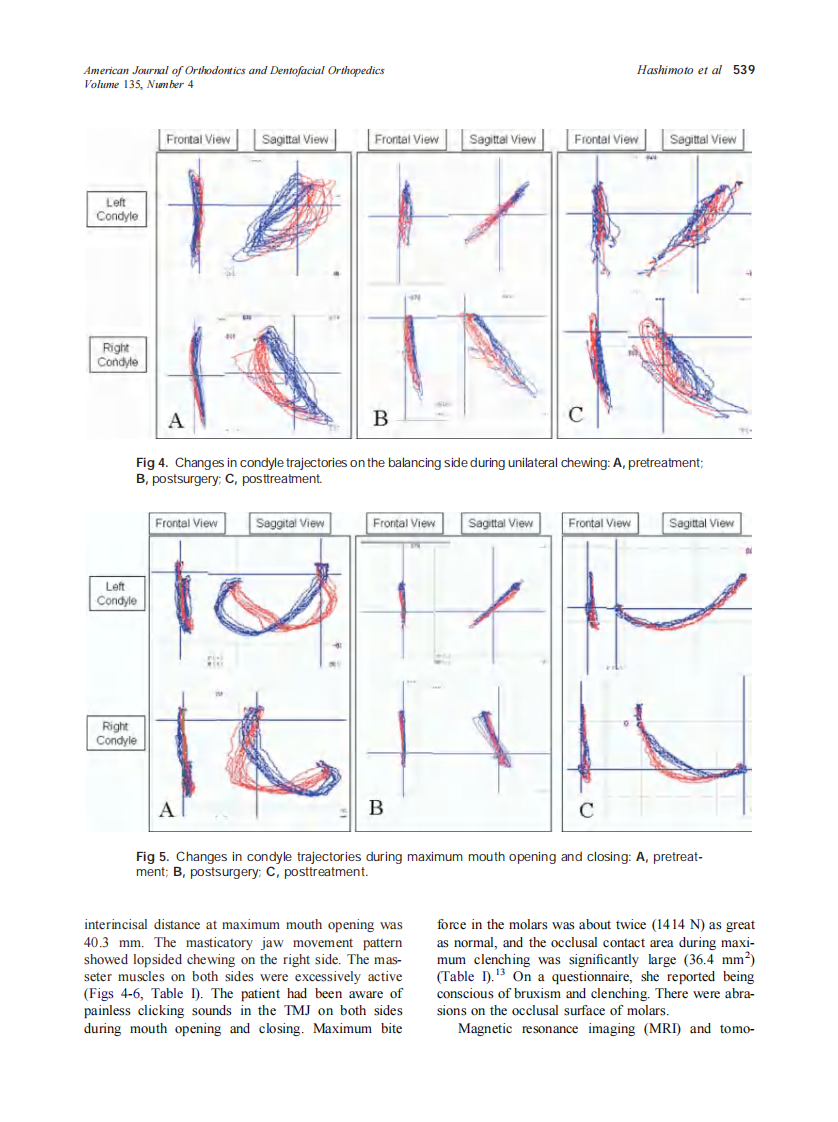 2009_135_4_536_548_Hashimoto.pdf 第4页