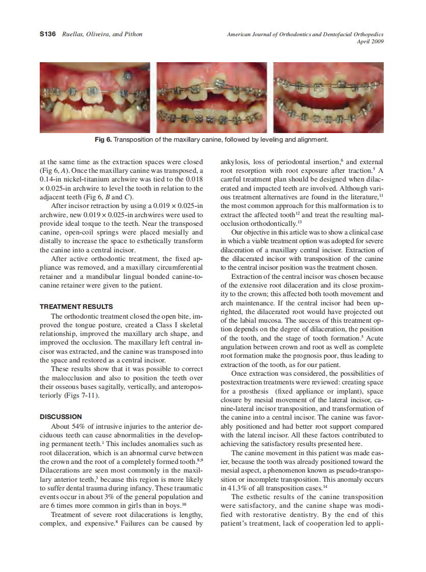 2009_135_4-Suppl-1_S133_S139_de-Oliveira-Ruellas.pdf 第4页