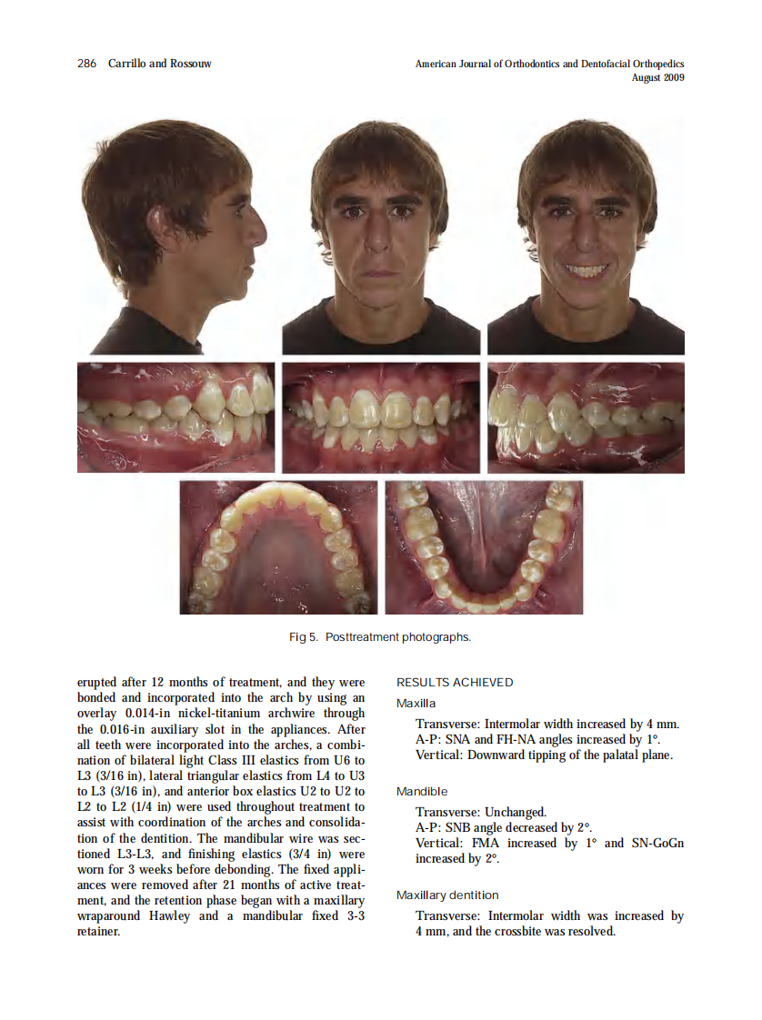 2009_136_2_282_289.pdf 第5页