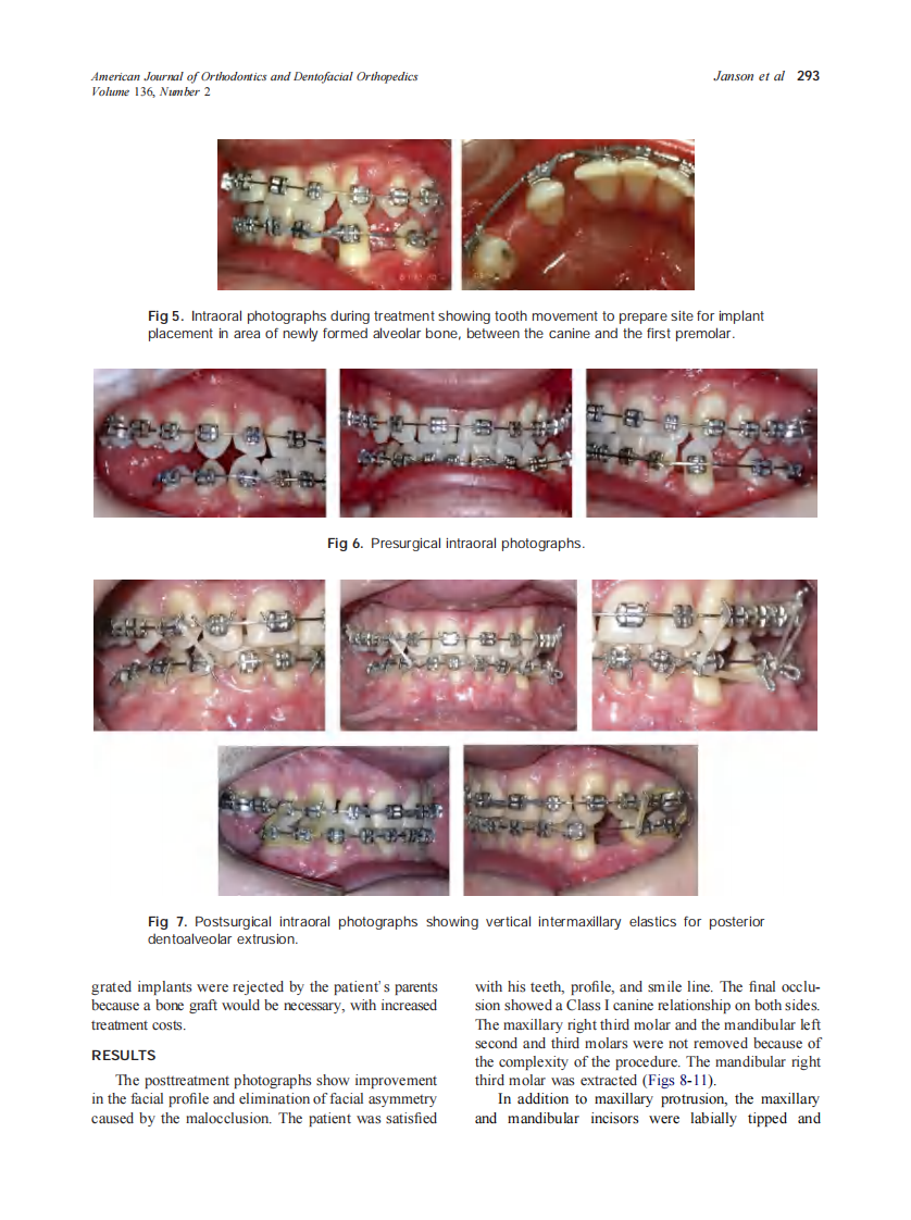 2009_136_2_290_298.pdf 第4页