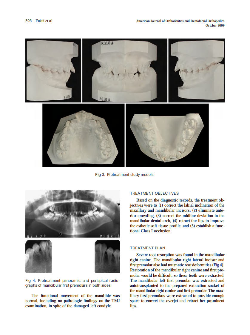 Fukui_2009_American-Journal-of-Orthodontics-and-Dentofacial-Orthopedics.pdf 第3页