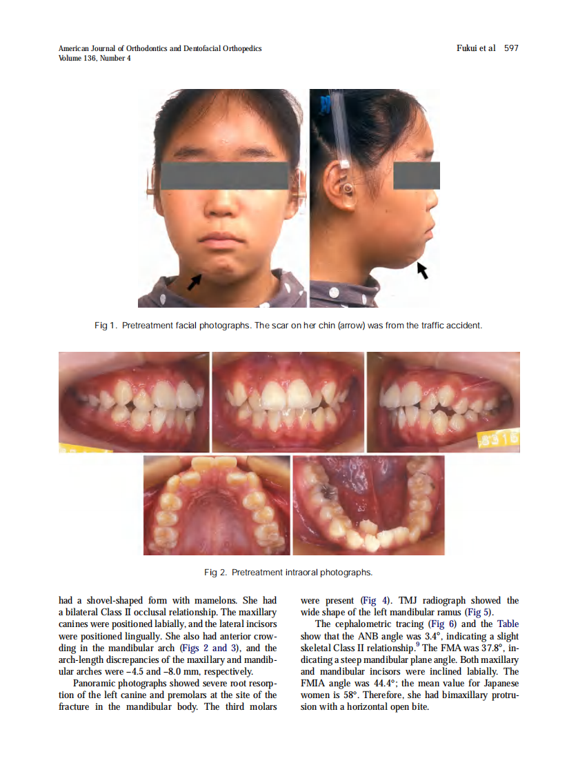 Fukui_2009_American-Journal-of-Orthodontics-and-Dentofacial-Orthopedics.pdf 第2页
