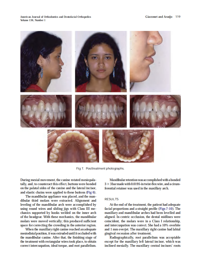 Giacomet_Orthodontic-correction-of-a-maxillary-canine-first-premolar-transposition_2009.pdf 第5页