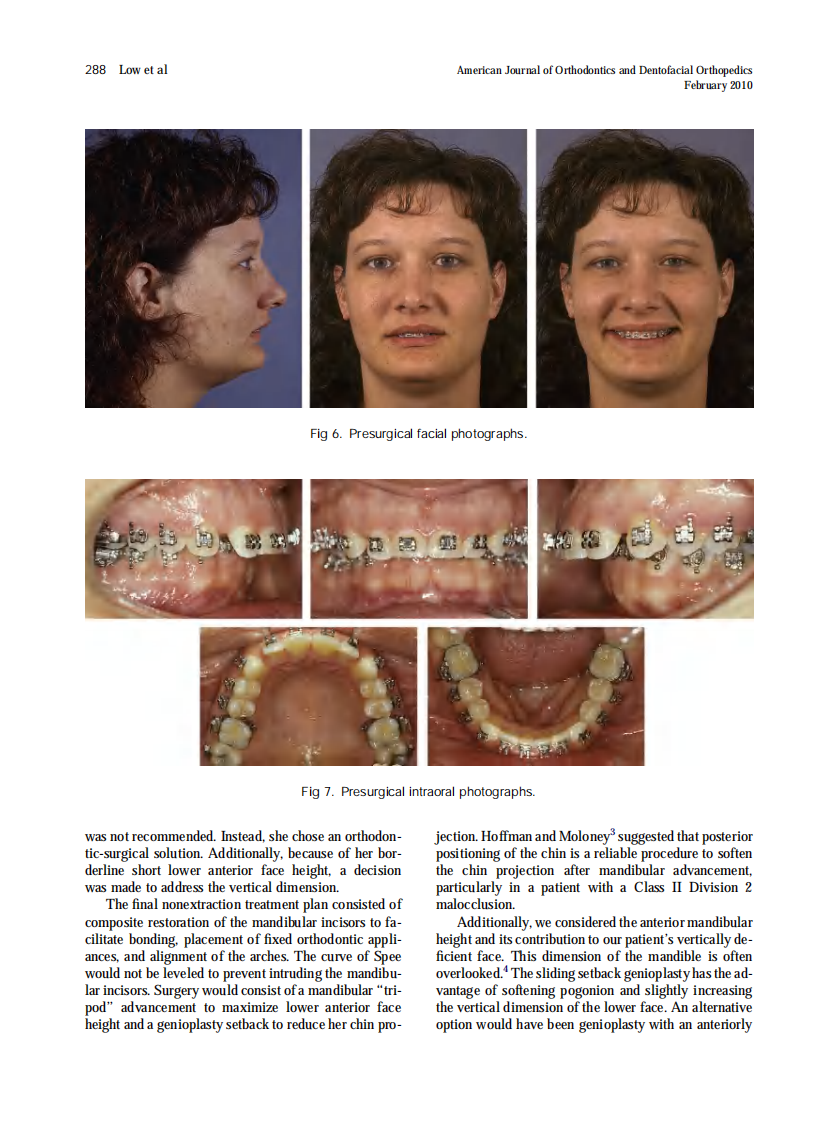2010_137_2_285_292.pdf 第4页