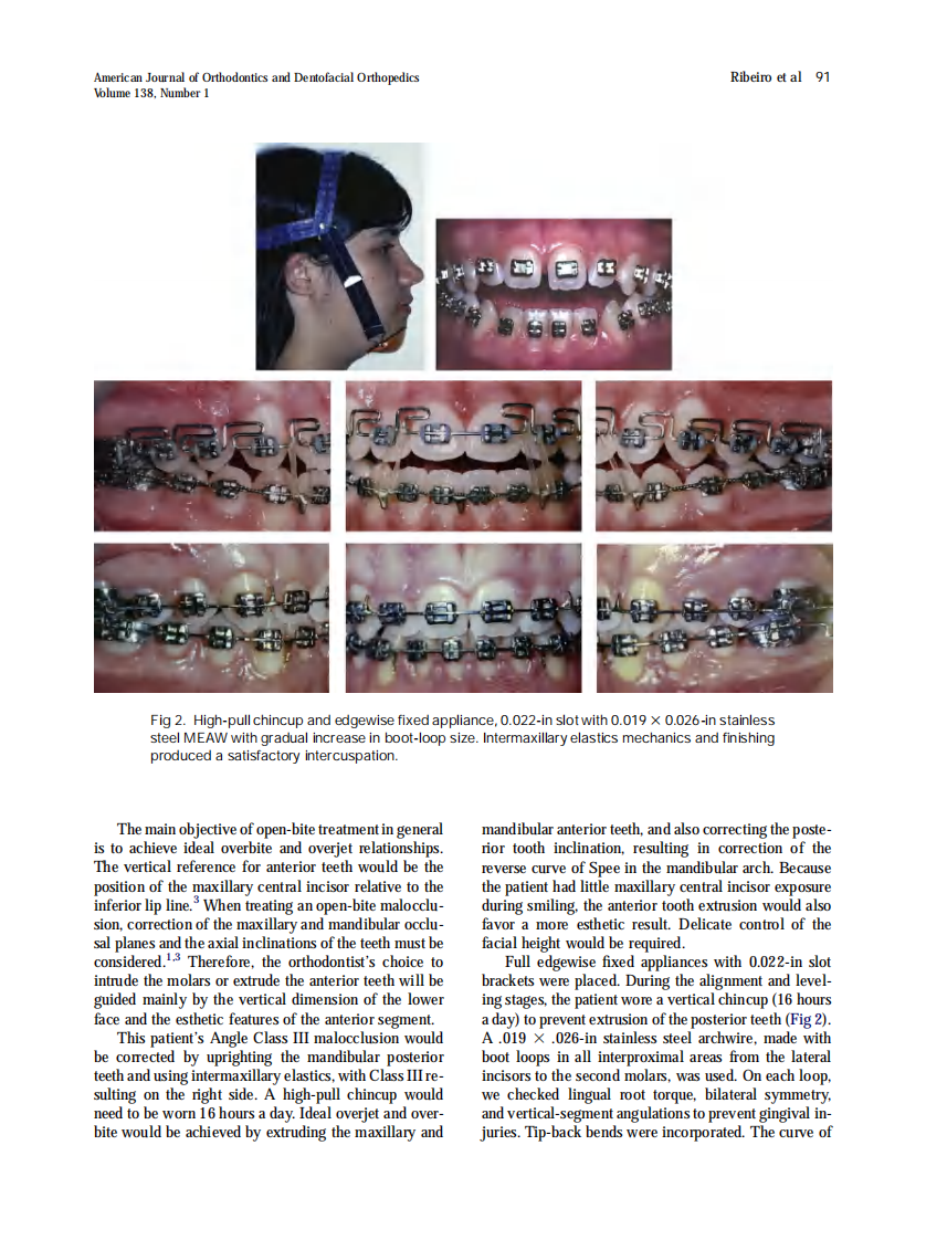 2010_138_1_89_95.pdf 第3页